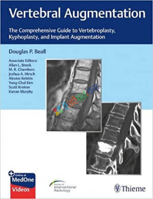 Vertebral Augmentation (Color)