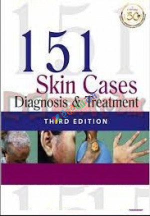 151 Skin Cases: Diagnosis and Treatment