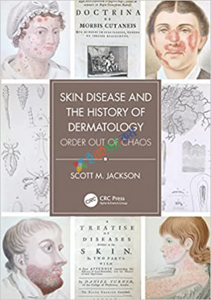 Skin Disease and the History of Dermatology (Color)