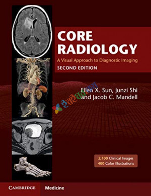 Core Radiology A Visual Approach to Diagostic Imaging (Color)