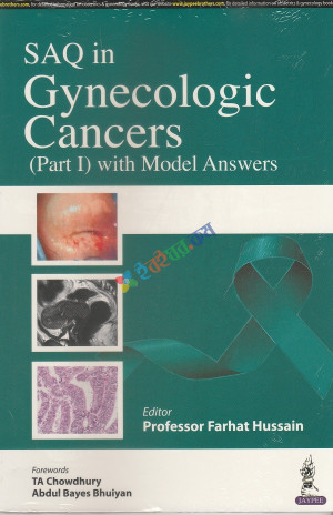 SAQ in Gynecologic Cancers (Part-1) With Model Answers ( Color )