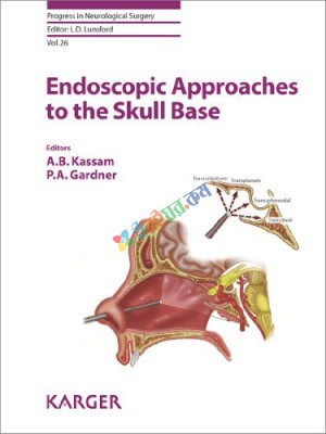 Endoscopic Approaches to the Skull Base (Color)