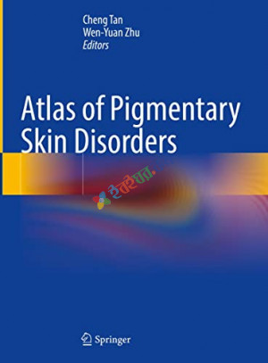 Atlas of Pigmentary Skin Disorders (Color)