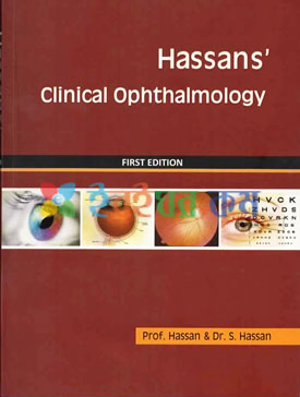 Hassans Clinical Ophthalmology