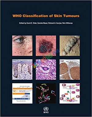 WHO Skin Tumours (Color)