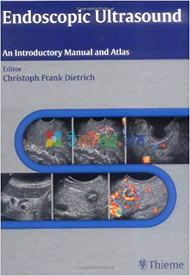 Endoscopic Ultrasound An Introductory Manual and Atlas