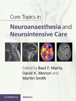 Core Topics in Neuroanaesthesia and Neurointensive Care (Color)