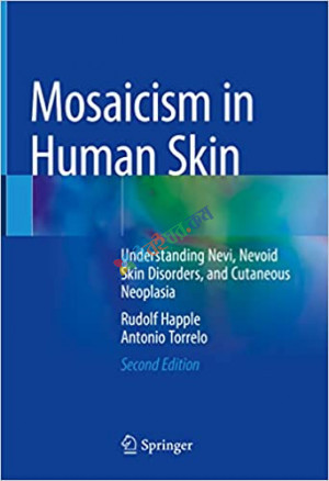 Mosaicism in Human Skin (Color)