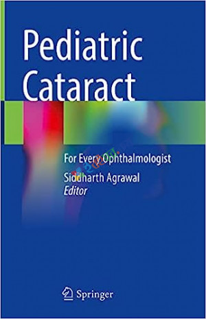 Pediatric Cataract (Color)