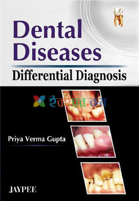 Dental Diseases Differential Diagnosis