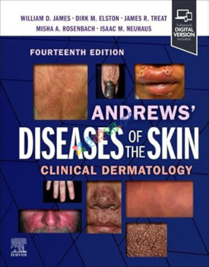 Andrews Diseases of the Skin Clinical Dermatology (Color)