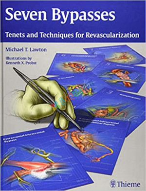 Seven Bypasses: Tenets and Techniques for Revascularization (Color)