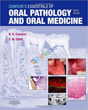 Cawson's Essentials of Oral Pathology and Oral Medicine (Color)