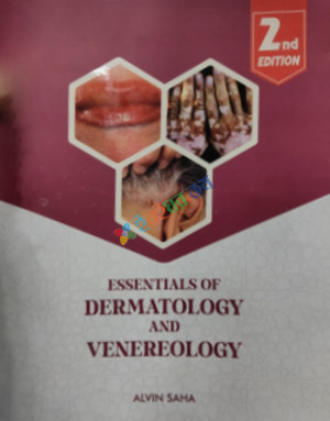 Essentials of Dermatology and Venereology