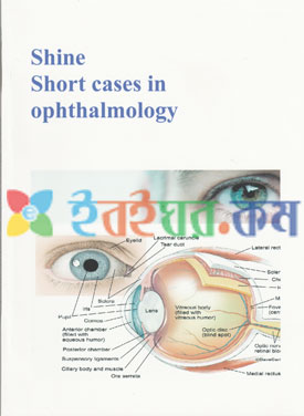 Shine Short Cases in Ophthalmology