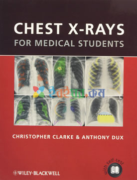 Chest X Rays For Medical Students (Color)