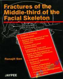 Fractures of the Middle-third of the Facial Skelton