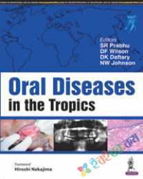 Oral Diseases in the Tropics