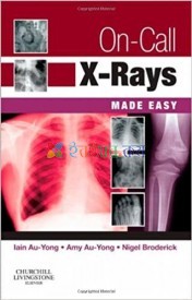 On Call X-Rays, Made Easy (Color)