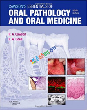 Cawson's Essentials of Oral Pathology and Oral Medicine (Color)