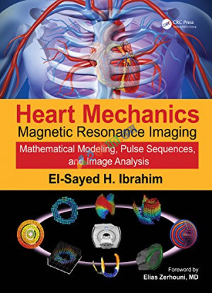 Heart Mechanics Magnetic Resonance Imaging
