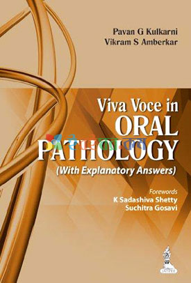 Viva Voce in Oral Pathology (With Explanatory Answers)
