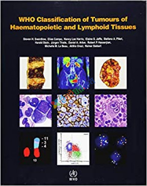 WHO Classification of Tumours of Haematopoietic and Lymphoid Tissues (Color)