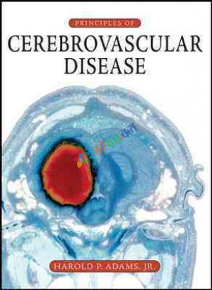 Principles of Cerebrovascular Disease