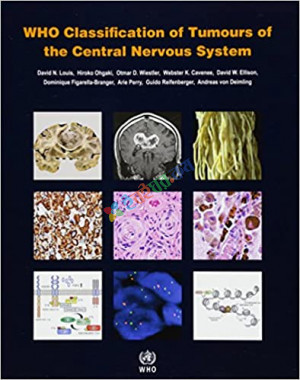 WHO Classification of Tumours of the Central Nervous System (Color)