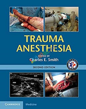 Trauma Anesthesia (Color0