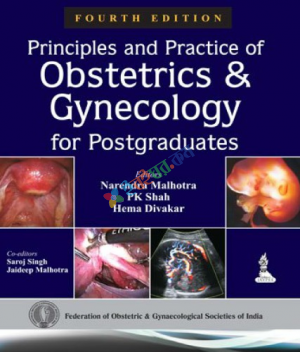 Principles and Practice of Obstetrics & Gynecology For Postgraduates (Color)