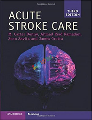 Acute Stroke Care (Color)