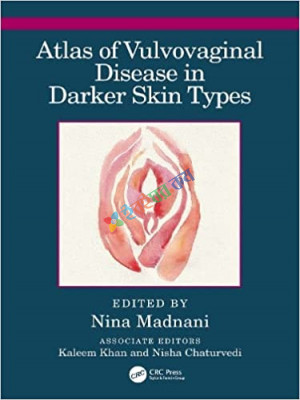 Atlas of Vulvovaginal Disease in Darker Skin Types (Color)