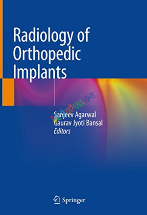 Radiology of Orthopedic Implants (B&W)
