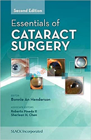 Essentials of Cataract Surgery (Color)