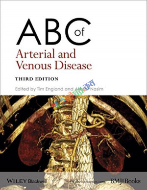 ABC of Arterial and Venous Disease (Color)