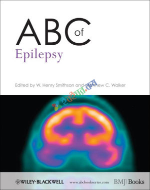 ABC of epilepsy  (Color)