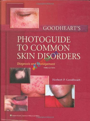 Goodheart's Photoguide to Common Skin Disorders: Diagnosis and Management (Color)