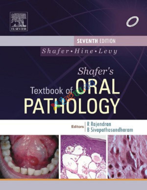 Shafer's Textbook of Oral Pathology (Color)