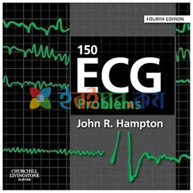 150 ECG Problems (Color)