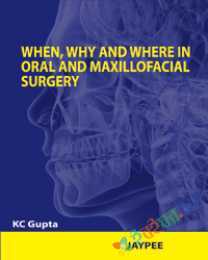 When  Why And Where In Oral And Maxillofacial Surgery
