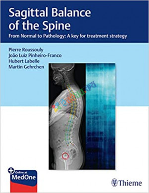 Sagittal Balance of the Spine (Color)