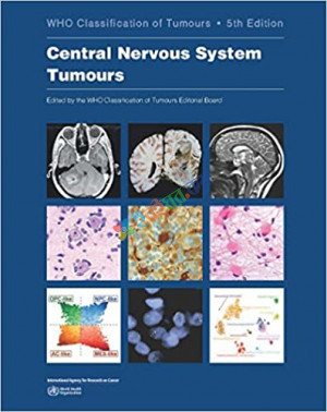 WHO Tumours of The Central Nervous System (Color)