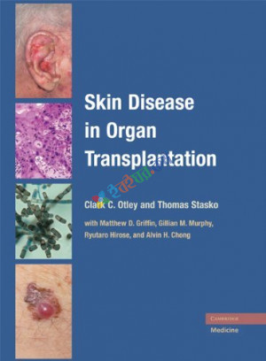 Skin Disease in Organ Transplantation (B&W)