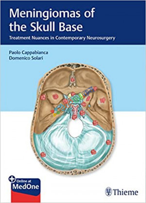 Meningiomas of the Skull Base (Color)