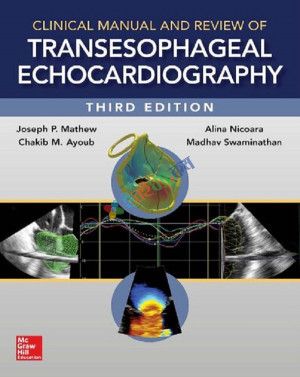 Clinical Manual and Review of Transesophageal Echocardiography (Color)