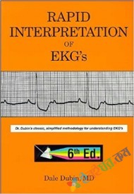 Rapid Interpretation of EKG's (eco)
