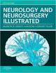 Functional Neurosurgery (Color)