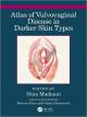 Clinical Atlas of Skin Tumors (Color)