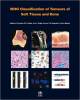 WHO Tumours of The Central Nervous System (Color)
